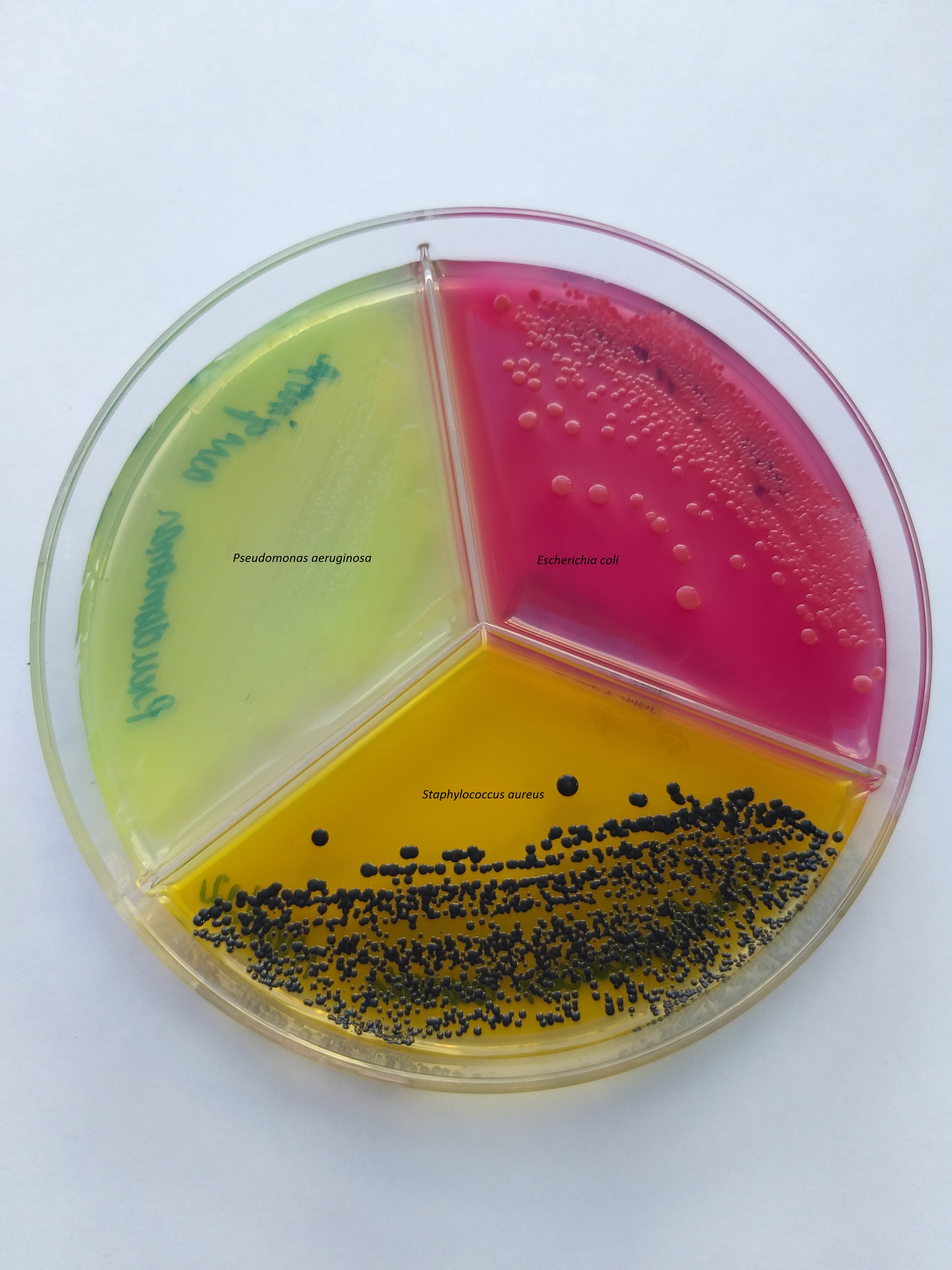 A importância do controle de qualidade microbiológica dos produtos de higiene pessoal, cosméticos e perfumes